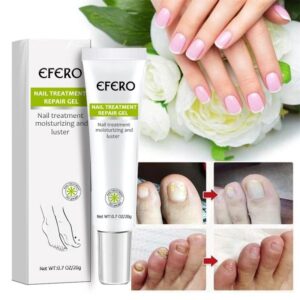 Crème réparatrice pour ongles ,pieds ,anti-infection